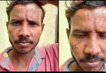 उप्र में जातिवादी गुंडों ने दलित के साथ क्रूरता की सारी हदें पार कीं