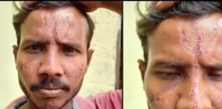 उप्र में जातिवादी गुंडों ने दलित के साथ क्रूरता की सारी हदें पार कीं