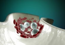 पहली बार इंसान के खून में माइक्रोप्लास्टिक का मिलना चिंता का विषय