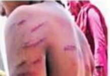 किताब लाना भूली बच्ची तो शिक्षक ने क्रूरता की हद पार की