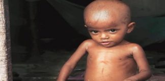 आदिवासी बच्चों में व्याप्त गंभीर कुपोषण, दक्षिण भारत ने बचाई लाज