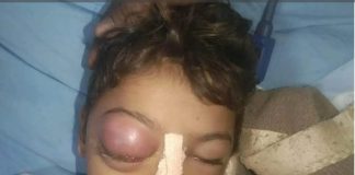 पानी का मटका छू लेने पर शिक्षक ने छात्र को बुरी तरह पीटा, छात्र की मौत