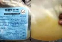 प्रयागराज में ब्लड प्लाज्मा की जगह मौसम्बी का जूस चढ़ाए जाने से मरीज की मौत