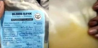 प्रयागराज में ब्लड प्लाज्मा की जगह मौसम्बी का जूस चढ़ाए जाने से मरीज की मौत