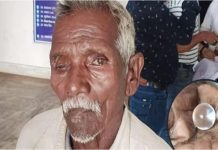 सरकारी योजना के मुफ्त इलाज ने 8 लोगों को बना दिया अंधा