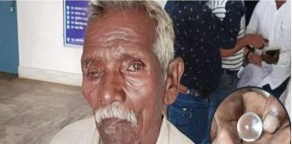 सरकारी योजना के मुफ्त इलाज ने 8 लोगों को बना दिया अंधा