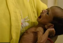 गुजरात मॉडल : बच्चों में कुपोषण की समस्या ज्यों की त्यों