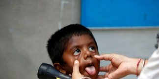 टीके से चूके 4 करोड़ मासूमों पर खसरे का खतरा