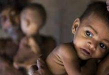 भाजपा का गुजरात मॉडल एक कुपोषित मॉडल है