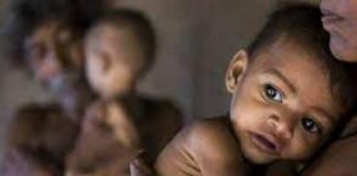 भाजपा का गुजरात मॉडल एक कुपोषित मॉडल है