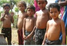 गुजरात के बच्चों में कुपोषण का स्तर चिंताजनक: राष्ट्रीय परिवार स्वास्थ्य सर्वेक्षण