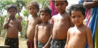 गुजरात के बच्चों में कुपोषण का स्तर चिंताजनक: राष्ट्रीय परिवार स्वास्थ्य सर्वेक्षण