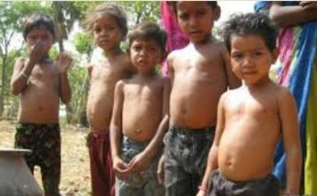 गुजरात के बच्चों में कुपोषण का स्तर चिंताजनक: राष्ट्रीय परिवार स्वास्थ्य सर्वेक्षण