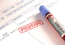 एचआईवी के नए संक्रमण दर में गिरावट क्यों थमी?